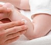 How to Treat Mild Eczema in Babies?